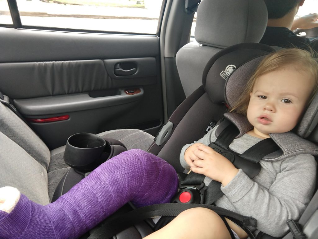 Baby girl in a cast